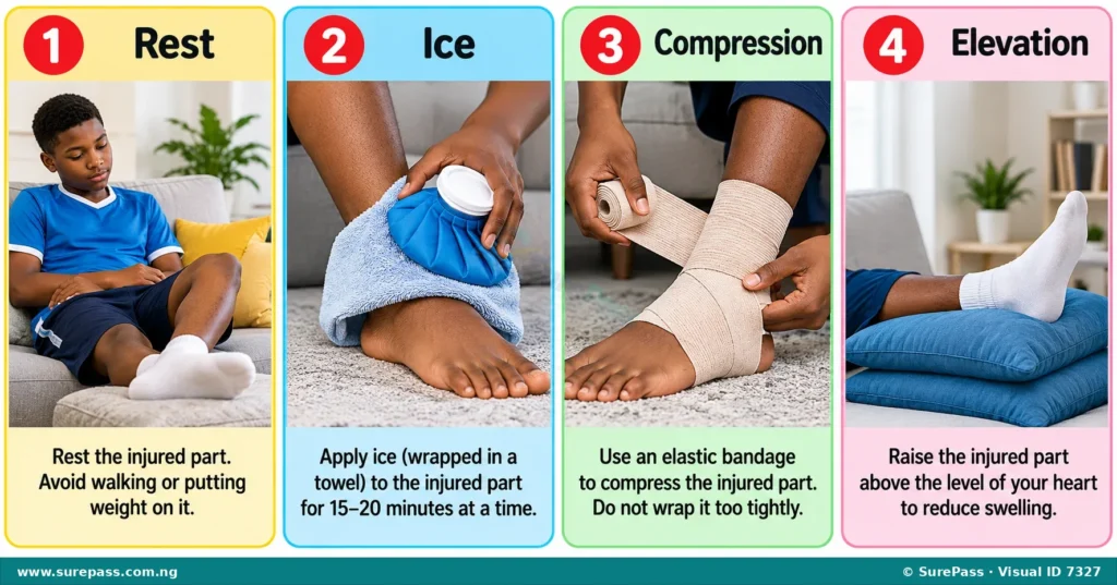 The R.I.C.E. method for treating sprains: Rest, Ice, Compression, and Elevation.
